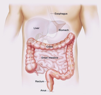 diagram of colon cancer colon cancer diagram www pixshark images galleries diagram of colon cancer colon cancer diagram www pixshark images galleries
